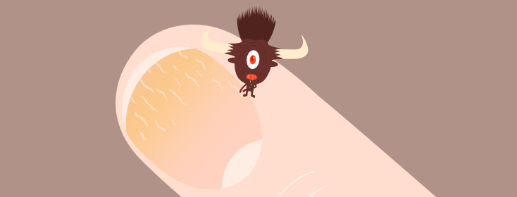 Can Psoriasis Cause Nail Problems?