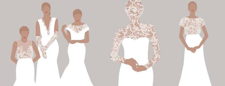 The Challenges Of Being A Bride With Psoriasis image