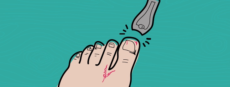 Guttate psoriasis diet 