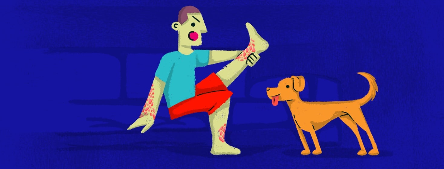 Is It Okay for My Dog to Lick My Plaque Psoriasis?