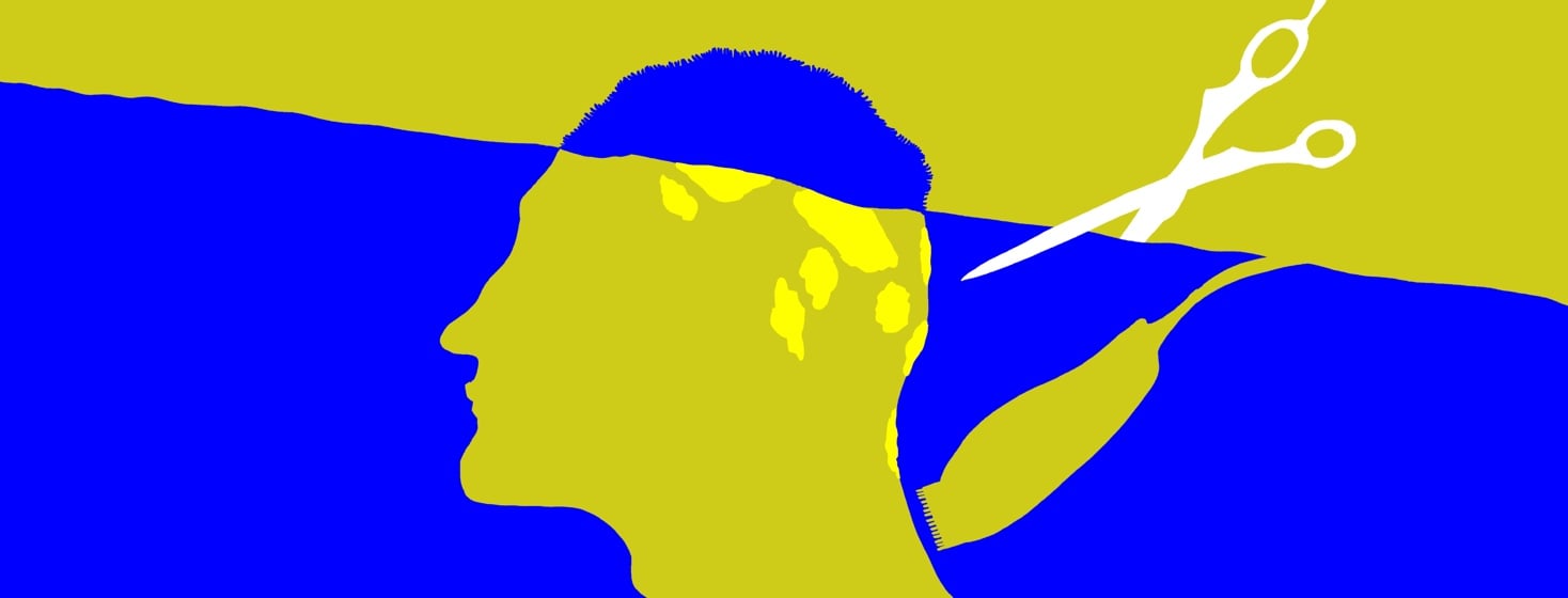 A silhouette of a male head with the top being shaved off by a clipper and scissors. There is scalp psoriasis depicted on the scalp.