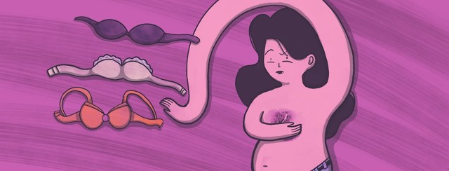 Psoriasis Between the Breasts image