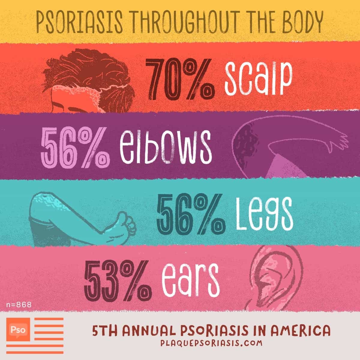A diagram showing specific body parts that psoriasis impacts including scalp, elbows, legs and ears.