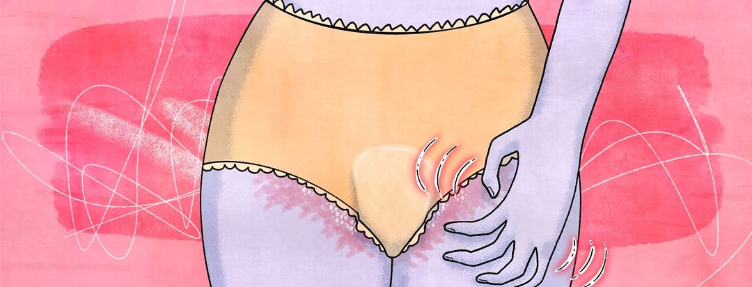 A woman wearing underwear showing the outline of a menstrual pad and edges of genital psoriasis. She is scratching the psoriasis showing.