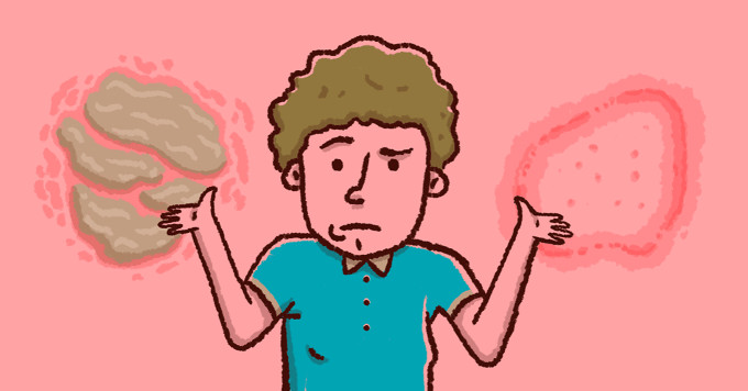 Psoriasis vs. Ringworm image
