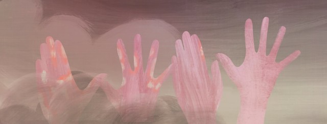 Hand Psoriasis and My Mental Health image