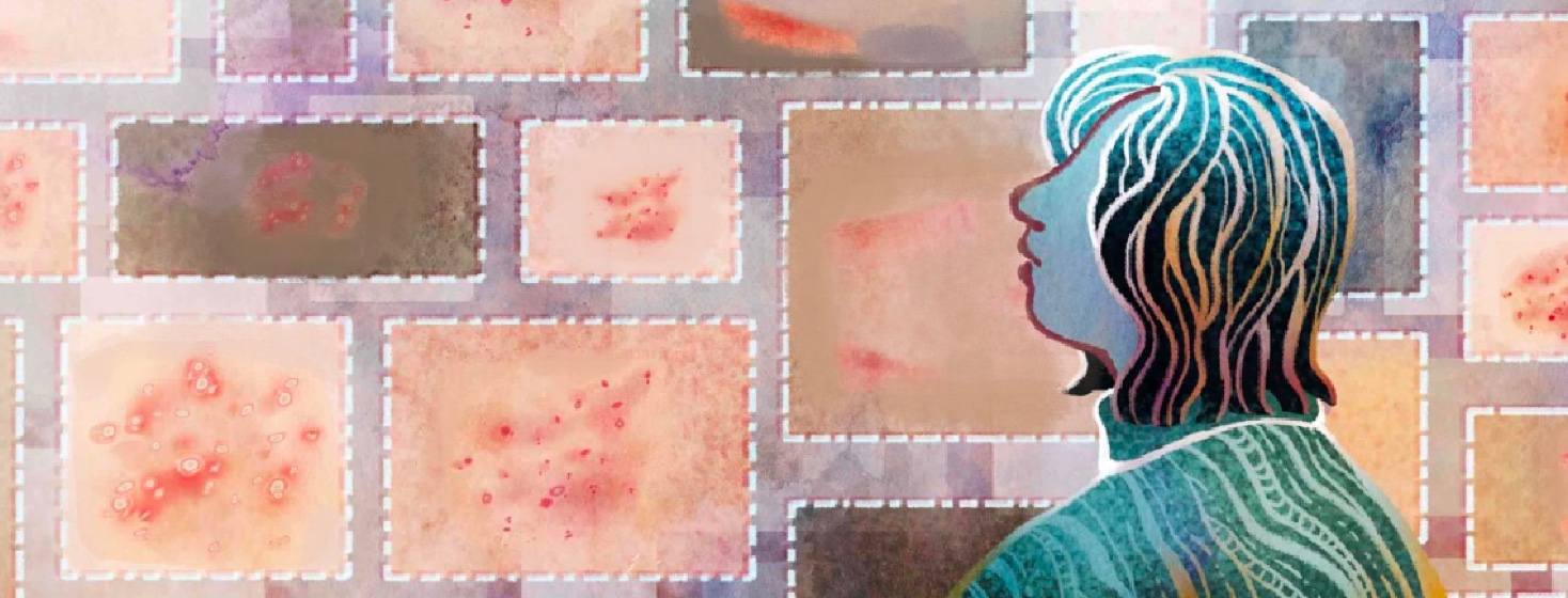 A woman views a virtual gallery showing the different ways that psoriasis can appear.