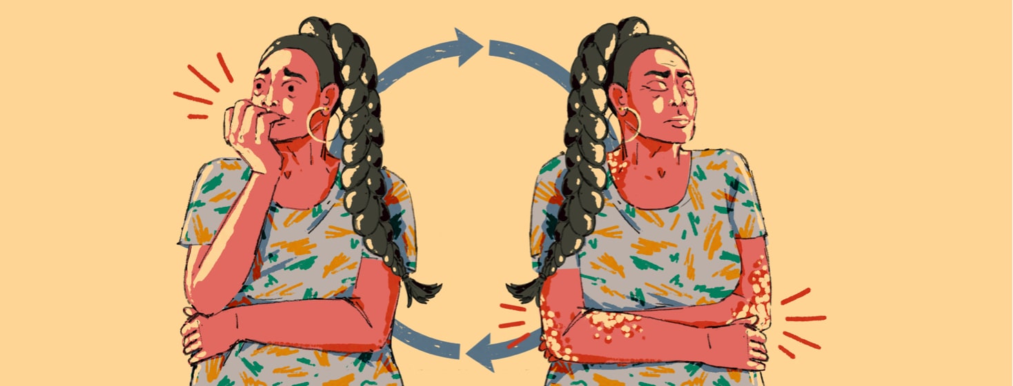alt=a women in a stress cycle, resulting in a psoriasis flare