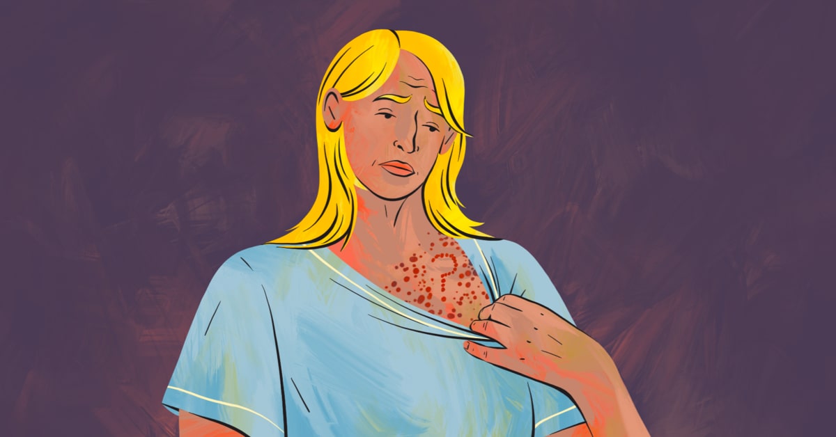 how-autoimmune-diseases-mix-match-including-psoriasis