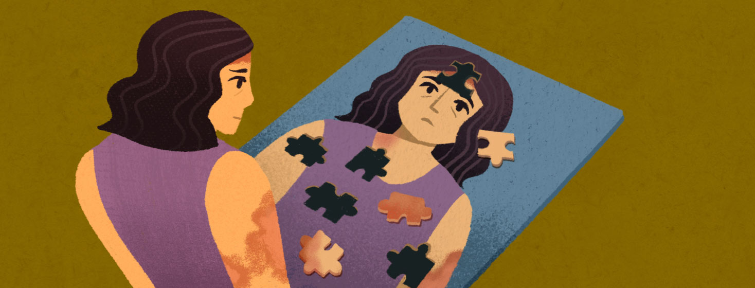Adult female with plaques looks at an image of herself that is in the form of an almost completed puzzle with pieces missing where there is some exposed skin. Confusion, symptoms, mysterious, psoriasis.