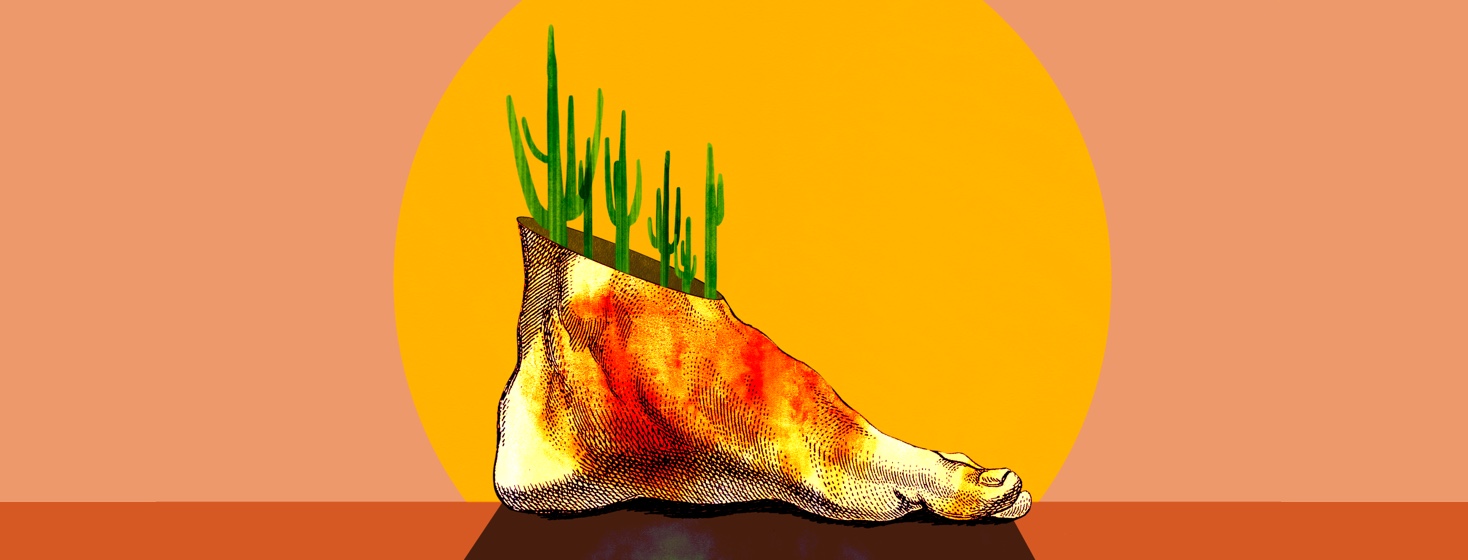 A foot in the sun with cactus growing out of its ankle