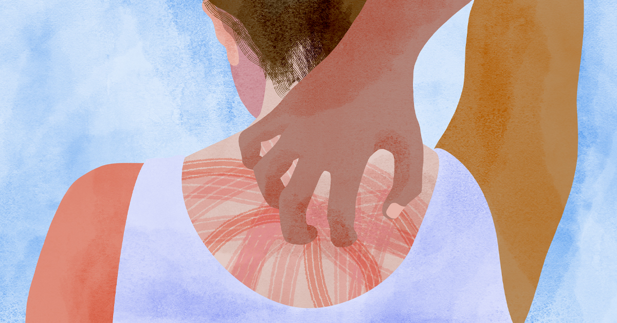 What Does Plaque Psoriasis Feel Like?