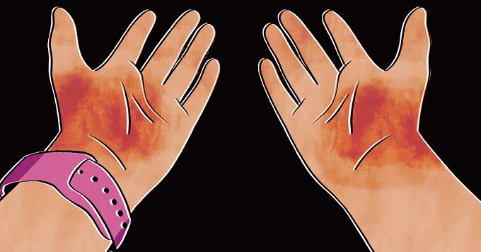 How Do You Handle Hard To Treat Areas? image