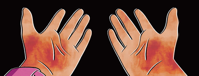 How Do You Handle Hard To Treat Areas? image
